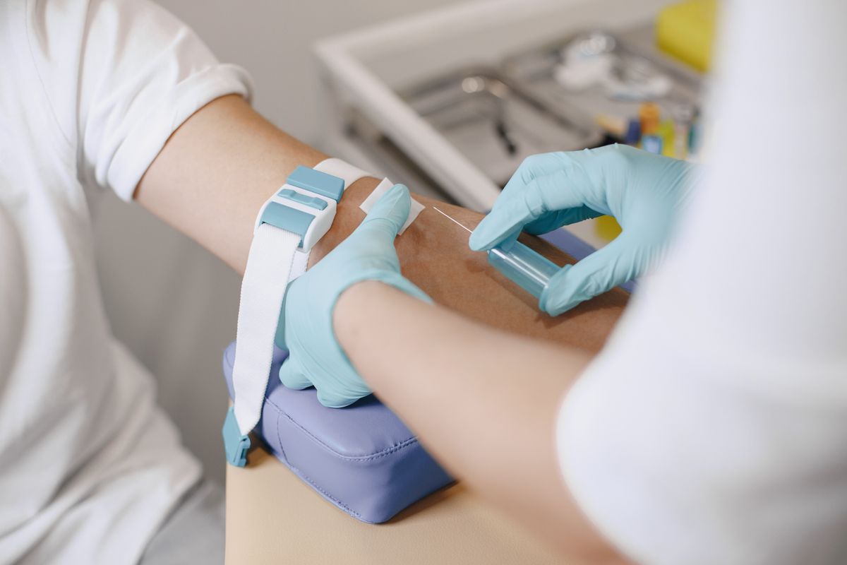 A forearm prepared for a test